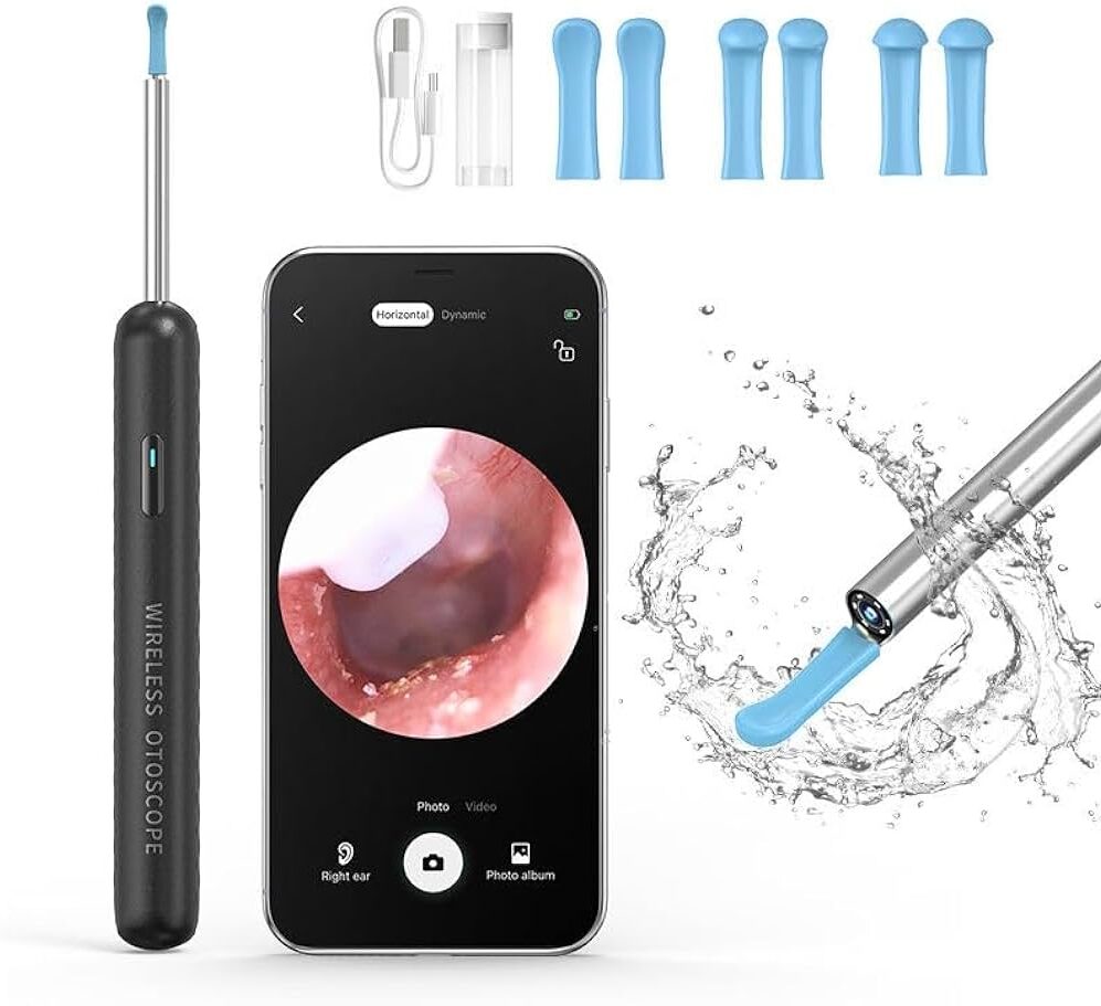 Ear Wax Removal Camera